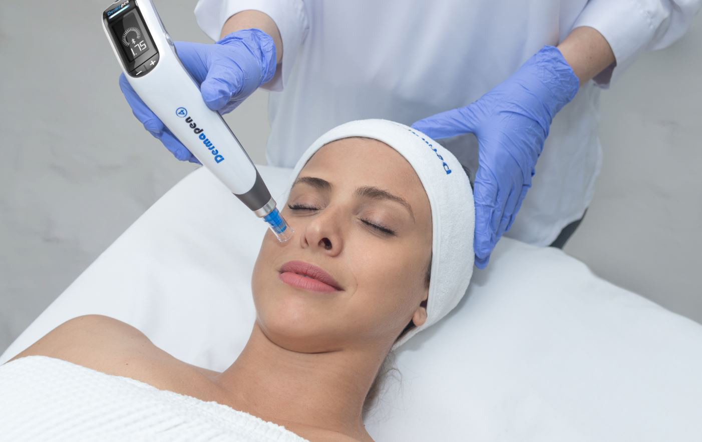 Microneedling mit dem Dermapen 4 