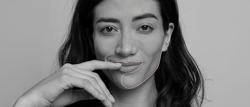 Lippen aufspritzen mit Hyaluronsäure in der Sophienklinik Stuttgart