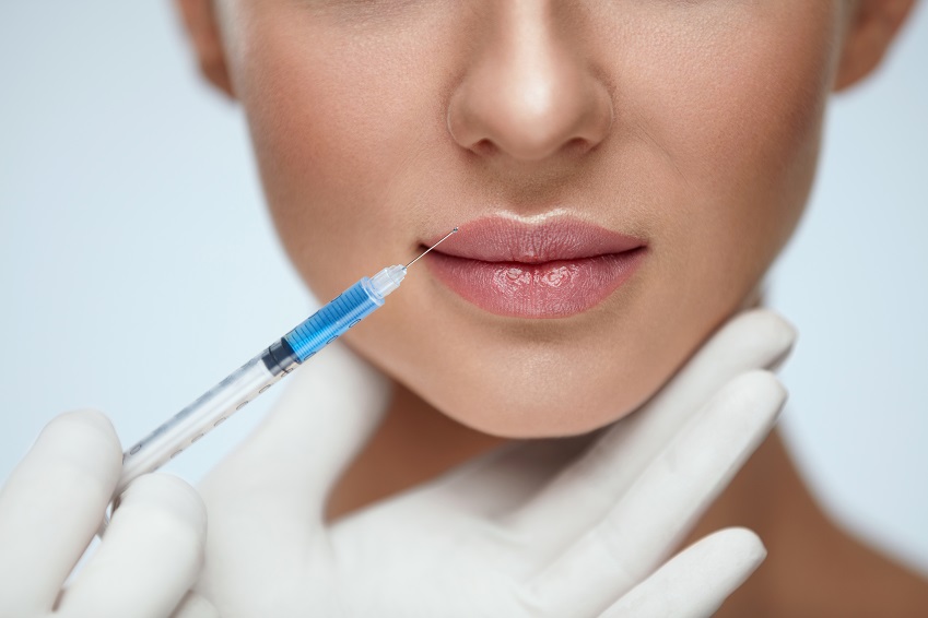 Botox® für die Lippen? — Alle Informationen über die Behandlung