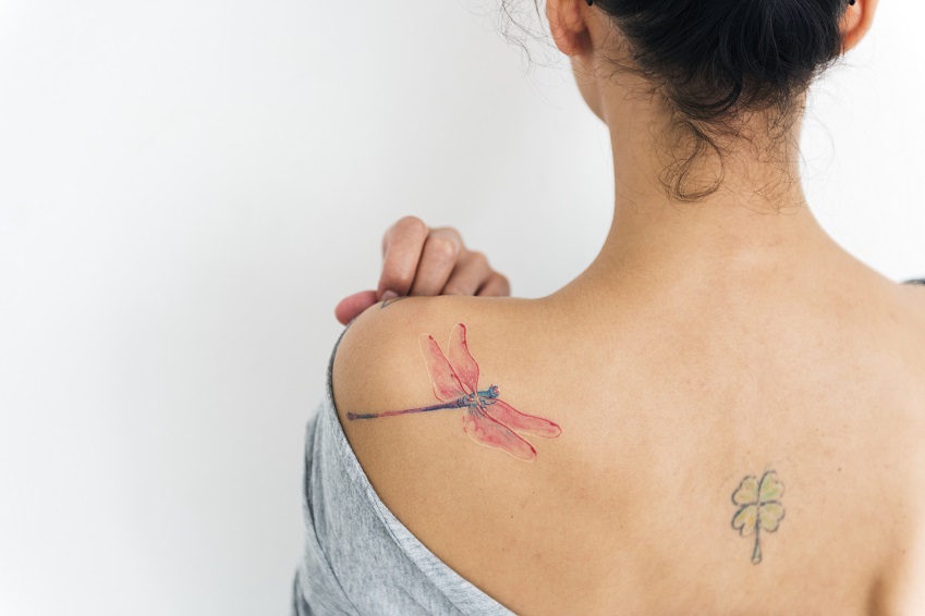 Laser Tattooentfernung: Kosten, Nebenwirkungen & Ablauf