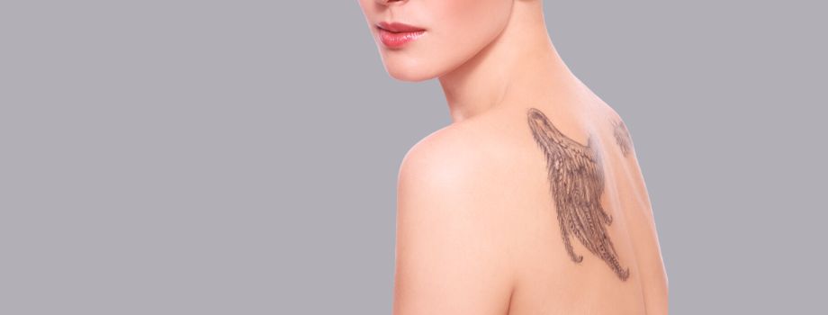 Tattooentfernung
